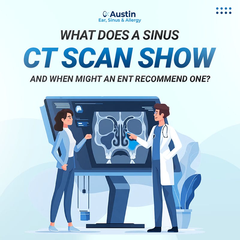 Sinus CT Scan Sinus CT Scan